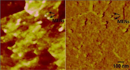 FIG. 8. AFM image pair (z height and phase (right)) for glioblastoma cells with MENs found in striations on the surface membrane. The observed nanoparticles are approximately 30-nm in diameter.
