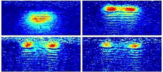 Absorption images of the atomic cloud splitting taken after 0 (top–left), 20 (top–right), 30 (bottom–left), and 40 (bottom–right) ms of illumination time, respectively.