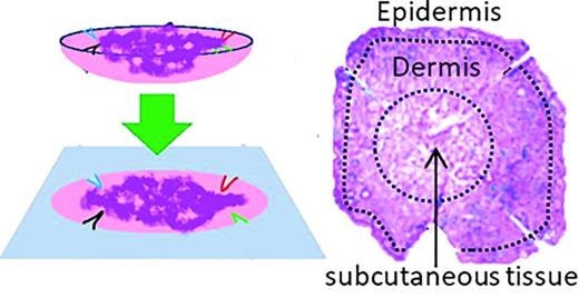 Fig. 1. Schematic showing how the initial tissue specimen (left) is flattened and sectioned on to the ITO coated glass slide for ToF-SIMS analysis. The H &amp; E stained tissue image (right) and the SIMS images (shown later) contain information from both the epidermis at the periphery of the tissue margins as well as dermal and subcutaneous tissue in the central part of the image. As a guide, dotted lines have been added to the H &amp; E image showing the approximate location of the epidermis (outside the outer dotted line), dermis (between the dotted lines), and the subcutaneous tissue (within the inner dotted line). Note that this is a generalization and each tissue slice was different and must be compared with the specific H &amp; E image for that sample.
