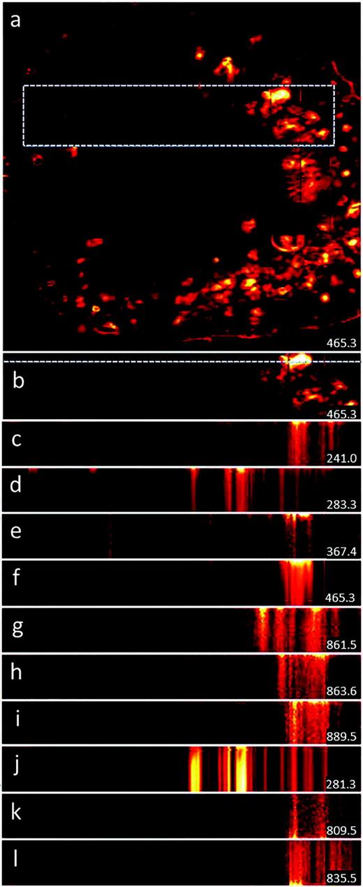 Fig. 2. SIMS images of selected species with signal intensity that varied with increasing primary ion dose density. An overview image (a) with the area of the multilayer analysis in negative ion mode (b) highlighted by a dashed box. A multilayer image seen from the top (b) with the location of the signal observed in the multilayer images [(c)–(l)] marked in by a dashed line. Multilayer images seen from the side with the surface of the sample at the top and the 32nd layer at the bottom [(c)–(l)]. Some signals decrease relative to the surface [(c)–(i)] some show little if any change (j) while others increase [(k) and (l)]. The detected m/z values of each species are displayed in the bottom right of each image. The overview image was 12 × 12 mm2 (384 × 384 pixels) and the image area of the multilayer data set was 10 × 2 mm2 (320 × 64 pixels).