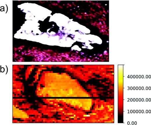 Fig. 2. (a) Optical image of pancreas tissue slice which has been H&amp;E stained to show adipocytes (fatty tissue). (b) Total ion image from fs-LDI-MS of adjacent tissue slice. Analysis area: (630 × 360) μm2 and the ion intensities are shown using a heat scale.
