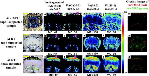 Fig. 3. Comparison of fly brains prepared by three different preparation and analysis procedures—tape-mounted at low temperature [(a), (d), (g), (j), and (m)], at room temperature [(b), (e), (h), (k), and (n)], and thaw-mounted at room temperature [(c), (f), (i), (l), and (o)]. The distributions of positive ions at m/z 549.5—ion fragment of TAG (44:1), and 521.5—DAG (30:1), respectively, and negative ions at m/z 281.2 [FA (18:1), oleic acid] and m/z 255.2 [FA (16:0), palmitic acid]. Scale bar is 200 μm. MC stands for maximal counts.