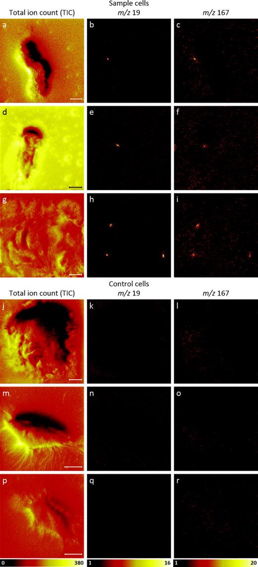 Fig. 3. TOF-SIMS tandem MS negative ion images of three transfected, ER-Tracker stained cells and three unstained (control) cells that were not transfected. Images of the [(a), (d), and (g)] TIC, [(b), (e), and (h)] m/z 19 signals, and [(c), (f), and (i)] m/z 167 signals acquired from each sample cell reveal colocalized hotspots of fluoride and pentafluorophenyl ions, respectively, from the ER-Tracker stain on each cell. Comparison between the ion images and the corresponding TIC images shows that these hotspots are not regions where all the negative ion signals were elevated. Images of the [(j), (m), and (p)] TIC, [(k), (n), and (q)] m/z 19 signals, and [(l), (o), and (r)] m/z 167 signals acquired on each of the three control cells show no local elevations in these two ER-Tracker-associated ions on the cells. The m/z 19 ion images in this figure were binned to 256 × 256 pixels, and the m/z 167 ion images in this figure were binned to 128 × 128 pixels for better visualization. All scale bars are 10 μm.