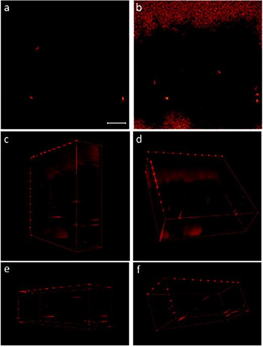 Fig. 4. Individual images and 3D image stacks compiled from 3D depth profile data show the m/z 19 signals at the surface of a transfected HEK cell and at distances up to approximately 40 nm below the surface. Pixel binning was not applied to these images. The image that corresponds to the top (a) of the 3D stack shows the m/z 19 fluoride ions that locate the ER-Tracker on the cell surface. The last m/z 19 ion image acquired at approximately 40 nm below the cell surface (b) reveals additional hotspots inside the cell. 3D image stacks of the full FOV [(c) and (d)] and a smaller region within the cell [(e) and (f)] show that the elevated m/z 19 signals were detected in cylindrical regions that appear at different distances from the cell surface. These cylindrical morphologies are consistent with endoplasmic reticulum tubules that occasionally form ER-PM junctions. The scale bar is 10 μm.