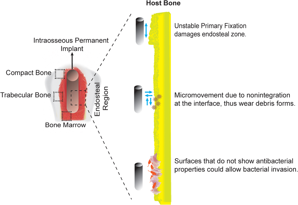 Multifunctional natural polymer-based metallic implant surface ...