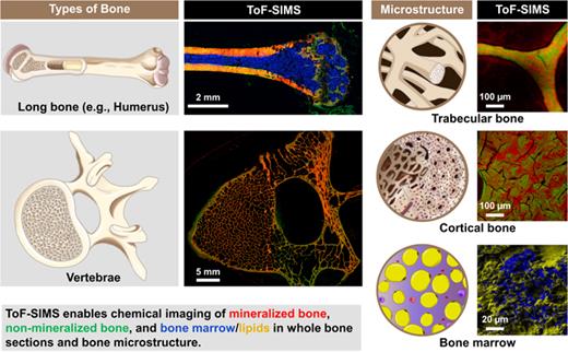 At the macroscopic level, long bones or vertebrae, for example, consist of outer cortical bone and inner trabecular bone, with the bone marrow found inside trabecular bone. The microstructure of both cortical and trabecular bone consists of lamellae, which are composed of bundles of mineralized collagen fibers. Whole bone sections as well as microstructure of cortical bone, trabecular bone, and bone marrow can be chemically imaged by ToF-SIMS. ToF-SIMS overlays show mineralized bone (mass signals of HAP, Table S6, Ref. 67) in red, nonmineralized bone (mass signals of collagen, Table S6, Ref. 67) in green, and bone marrow (lipid mass signals, Table S7, Ref. 67) in blue and yellow.