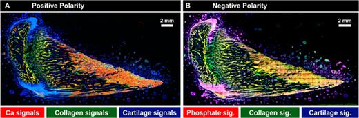 Large overview ToF-SIMS scan of a rat femur, obtained with (a) positive and (b) negative polarity. Calcium signals, which represent mineralized bone (shown in red, Table S6, Ref. 67), are more easily ionized positively. In negative polarity, mineralized bone can be shown by phosphate signals (red, Table S8, Ref. 67). However, since phosphates can originate not only from hydroxyapatite but also from other molecules (e.g., phosphatidylcholine, main component of biological membranes), phosphate signals overlap with signals from cartilage tissue when measured in negative polarity. In both positive and negative polarity, nonmineralized bone tissue is shown as collagen signals in green and cartilage signals are shown in blue (Tables S6 and S8, Ref. 67).
