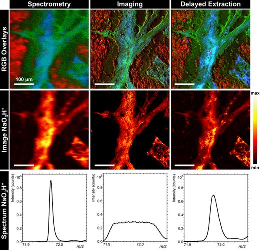 Comparison of different ToF-SIMS modes using the example of detailed images in the defect area of a rat femur with implanted biomaterial. First row: In RBG, overlay images of all three measurement modes, mineralized bone in form of HAP signals are shown in red, nonmineralized bone tissue is shown as collagen signals in green and cartilage signals are shown in blue. Second row: Ion images of NaO3H+, a cartilage signal. Third row: Mass spectrum for the NaO3H+ signal. In all rows, results of spectrometry measurement are shown on the left, the imaging mode is shown in the middle, and the delayed extraction mode is shown on the right. All used mass signals are listed in Table S6 (Ref. 67).