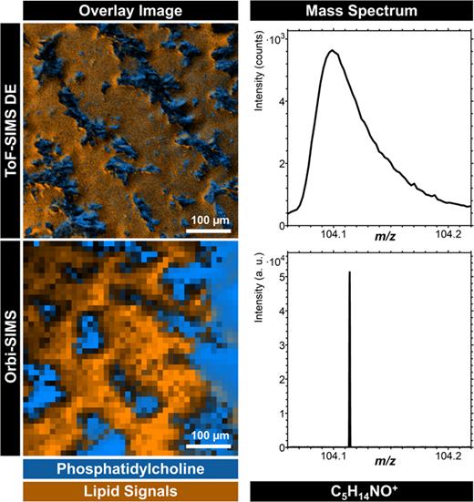 Comparison of Orbi-SIMS and ToF-SIMS imaging analysis of bone marrow. For ToF-SIMS high-resolution imaging analysis in the delayed extraction mode (ToF-SIMS DE), 30 keV Bi3+ cluster primary ions were used. For OrbiTrap™ imaging analysis, 20 keV Ar3000+ cluster primary ions were applied. In overlay images of both ToF- and Orbi-SIMS measurements, phosphatidylcholine (major component of biological cell membranes) signals are shown in blue and lipid signals are shown in orange. Based on the mass signal of a phosphatidylcholine fragment, C5H14NO+, the significantly improved mass resolution of Orbi-SIMS analysis compared to ToF-SIMS DE analysis can be seen. All used mass signals are listed in Tables S7 and S9 (Ref. 67).