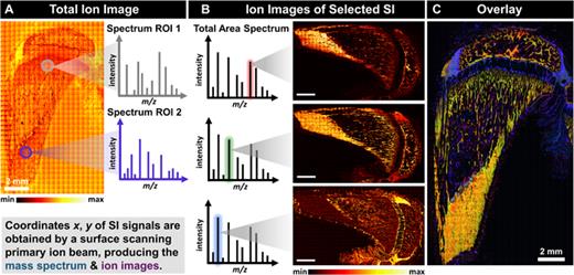 Basic principles of surface imaging and spectrometry. (a) Regions of interest (ROI) analysis, chosen from the total ion image, allows to study mass spectra in specific areas of the sample surface. (b) Individual SI images are obtained by selecting different ion masses in the mass spectrum. (c) SI images can also be assigned to different colors and merged into an overlay image (here, three SI images in red, green, blue are merged). (Scale bars = 2 mm.) All used mass signals are listed in Table S6 (Ref. 67).