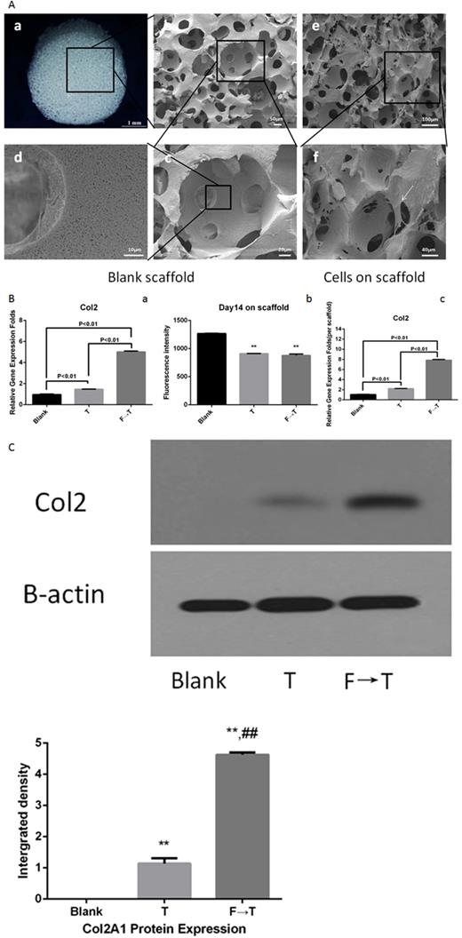 Basic characteristics of NF PLLA scaffolds support cell growth and sequential release from the 3D scaffold. (A) Gross and scanning electron microscopy view of porous NF PLLA scaffolds as well as cell attachment on the scaffolds. Gross (a) and SEM [(b)–(d)] observation showed that the PLLA scaffolds were fabricated with a uniform porous structure and high interconnectivity. The walls of the pores are nanofibrous. ADSCs were retained in the pores and adhered to the scaffold’s walls (e and f, white arrow indicates the cell attached on the scaffold). (B) Gene expression and cell numbers of mouse ADSCs in 3D culture. The gene expression of interest was normalized to the expression of the housekeeping gene 18S. (a) Collagen type II expression. (b) Fluorescence intensity of CellTiter-Blue assay for cell proliferation in each group. (c) Average collagen type II expression (**P < 0.01) (n = 3). (C) Western blot and densitometric data of collagen type II in 3D culture. **P < 0.01 vs blank; ##P < 0.01 vs TGFβ1 (n = 3).