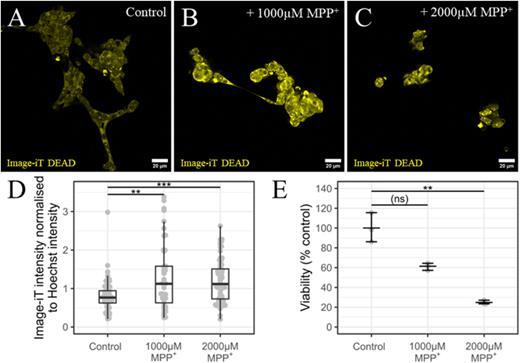 Measurement of cytotoxicity in MPP+ treated SH-SY5Y cells. Differentiated SH-SY5Y cells were cultured under static conditions and treated with MPP+ for 24 h prior to fixation and staining with Image-iT DEAD (yellow). Immunofluorescent images of (a) non-treated cells and (b) treated with 1000 or (c) 2000 μM of MPP+. Scale bars 20 μm. (d) Quantification of Image-iT DEAD staining from immunofluorescent images. Data normalized to the total Hoechst intensity per image as a control for the cell number. Data representative of two independent experiments with 15–45 images analyzed per treatment group. (e) Quantification of cell viability of untreated cells or treated with 1000 or 2000 μM of MPP+. **p ≤ 0.01 and ***p ≤ 0.001.