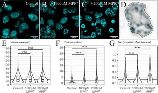 Alterations to the nuclear morphology following MPP+ treatment. Immunofluorescent images of differentiated SH-SY5Y cells maintained under static conditions in chamber slides for 24 h prior to fixation and staining with Hoechst nuclear DNA stain (cyan). Immunofluorescent images of (a) non-treated cells and (b) treated with 1000 or (c) 2000 μM of MPP+. Scale bars 10 μm. (d) Example image of dense foci (cyan outlines) detected within a nucleus. Quantification of Hoechst staining from immunofluorescent images. Graphs depict (e) the nuclear area and (f) foci number per nucleus and G. Proportion of the nuclear area within foci. Data normalized to the total Hoechst intensity per image as a control for the cell number. Data representative of two independent experiments with 30 images analyzed per treatment group. ****p < 0.0001.