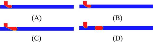 FIG. 2. Four steps of the slug formation process inside the microfluidic T-junction.