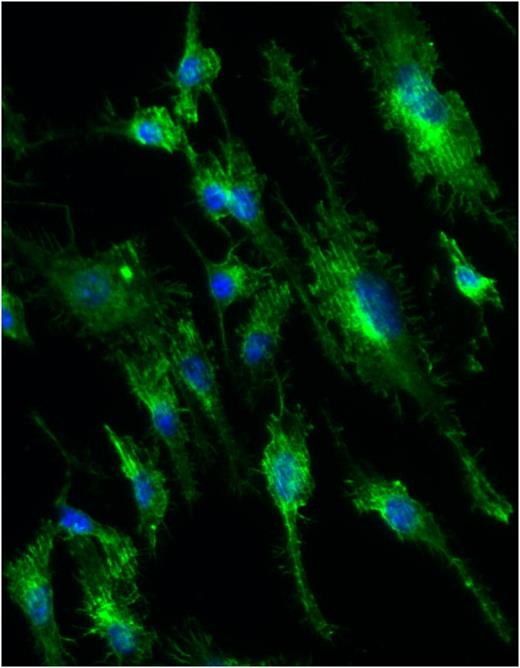 Macrophages on the wrinkle: Exploring microscale interactions with ...
