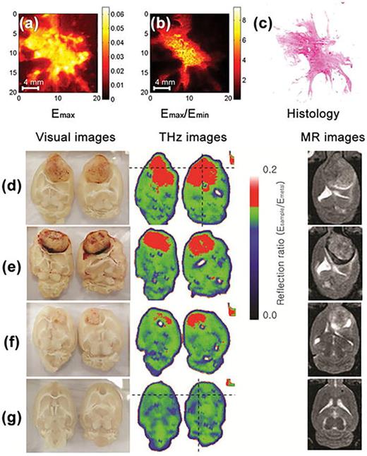 FIG. 18. THz reflected images of breast tissue plotted by (a) Emax, (b) Emax/Emin, respectively, compared to (c) the hisotology image. (a)–(c) are reproduced with permission from Ashworth et al., Opt. Express 17, 12444–12454 (2009).291 Copyright 2009 Optical Society of America. (d)–(g) Visual, THz, and magnetic resonance (MR) images of brain tissues (d)–(f) with and (g) without brain tumor. The THz image size is 4 × 3 cm2. (d)–(g) are reproduced with permission from Oh et al., Biomed. Opt. Express 5, 2837 (2014).158 Copyright 2014 Optical Society of America.