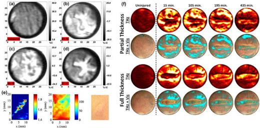 FIG. 24. (a)–(d) THz images of the water content of rat skin increasing time following a burn, reproduced with permission from Tewari et al., J. Biomed. Opt. 17, 040503 (2012).315 Copyright 2012 SPIE. (e) THz images of the refractive index (left) and absorption coefficient (middle) at 1 THz of a scar six months following the injury, compared to the visible image (right) of the same region. Reproduced with permission from Fan et al., J. Biphotonics 10, 1143–1151 (2017).316 Copyright 2017 Wiley-VCH Verlag GmbH &amp; Co. KGaA, Weinheim. (f) Images of partial and full thickness burns of the THz reflectivity and the THz reflectivity combined with a visible image of the region increasing time after a burn. Reproduced with permission from Tewari et al., Biomed. Opt. Express 10, 322–337 (2019).317 Copyright 2019 Optical Society of America.