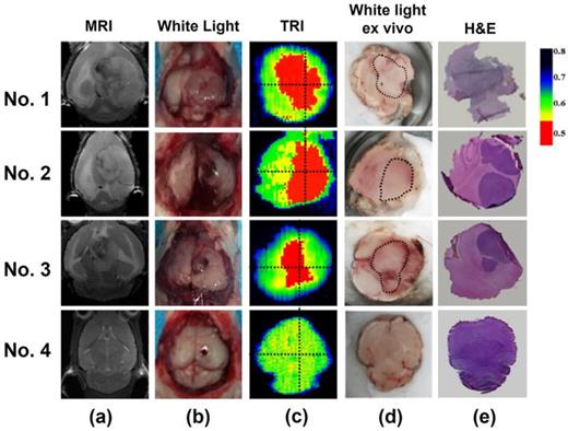 FIG. 26. Brains of mice with glioma (1–3) and a healthy mouse (4) imaged in vivo with MRI (a), visible light (b) and THz (c) and ex vivo images (d), and histological results (e) of the same regions. Reproduced with permission from Wu et al., Biomed. Opt. Express 10, 3953 (2019).309 Copyright 2019 Optical Society of America.