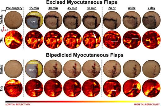 FIG. 27. The visible and THz images of fully and partially excised skin flaps, respectively, increasing time following the procedure. Reproduced with permission from Bajwa et al., Biomed. Opt. Express 8, 460 (2017).330 Copyright 2016 Optical Society of America.