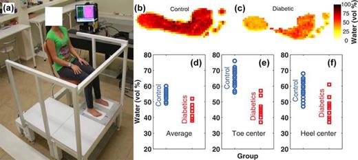 FIG. 28. Assessing diabetic foot syndrome with THz imaging: (a) the experimental setup used to image the foot with the skin in contact with an imaging window; (b) THz images of the water content of the feet of healthy and diabetic subjects; and (c) the distribution of the water content in the different foot regions for healthy and diabetic subjects. Reproduced with permission from Hernandez-Cardoso et al., Sci. Rep. 7, 42124 (2017).331 Copyright 2017 Authors, licensed under a Creative Commons Attribution (CC BY) license.