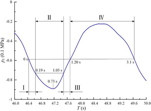 Four stages of LFLA oscillation divided according to the flow patterns observed inside the cavity.