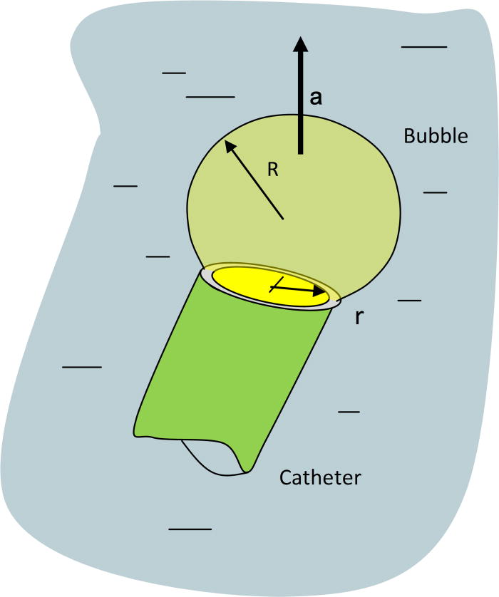 Understanding the basic concepts of CO2 angiography | Journal of ...