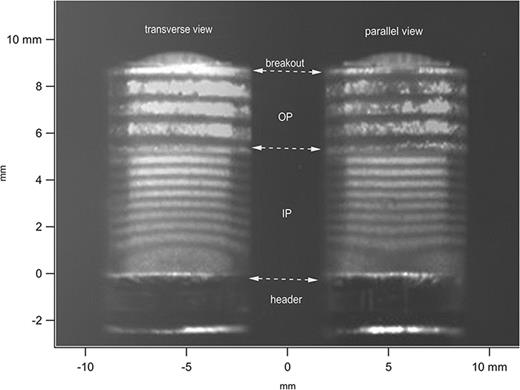 Experimental observations of exploding bridgewire detonator function ...