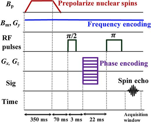 High-resolution ultra-low field magnetic resonance imaging with a high ...