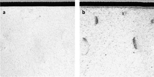 Cross-sectional bright-field STEM images for the sample initially annealed at 1300 °C for 10 min followed by annealing at 1450 °C for 10 min with diffraction vector (a)    g  =   ⟨ 0002 ⟩ and (b)    g =  ⟨  11   2 ¯ 0 ⟩. The PIDs that form during an anneal at 1300 °C [Figs. 2(a) and 2(e)] can be dissolved by subsequent high temperature annealing.