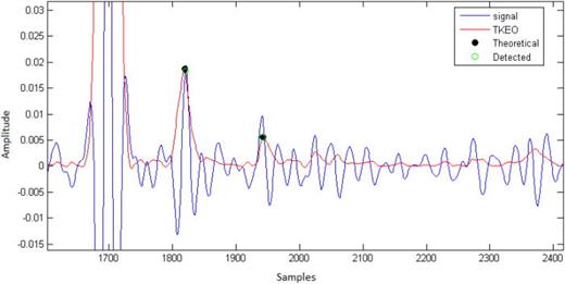 FIG. 2. (Color online) Peaks detection on TKEO output.