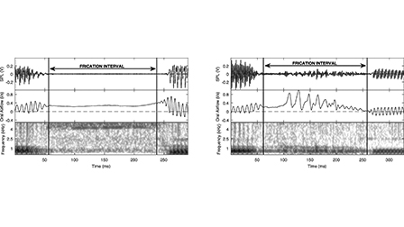 Source characteristics of voiceless dorsal fricatives | The Journal of ...