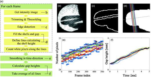 (Color online) Calculation of the time-dependent gap height from the intensity video.
              (a) The flowchart of the processing. (b) An example of a recorded intensity image. (c)
              An edge image calculated using the intensity image. (d) The filled image and lines
              used for calculating the gap height (solid lines). The number of pixels along the
              solid lines are counted for each frame. The dashed line indicates the major axis of
              the shells. (e) The counted pixel numbers (circle plots) at each frame and their
              filtered curve (solid lines). (f) The gap heights along each line hj (thin lines) and their average h (thick line). Please refer to Appendix A for
              the details of each step.