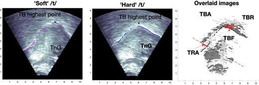 Fig. 1. (Color online) Mid-sagittal cross-sections of [tj] (left) and [t] (center), and their overlaid TaO image [cf. Lulich and Cavar (2019)]. The position of the tendon of the genioglossus (TnG), the line from the tendon to the tongue root surface and the point of the highest raising of the tongue dorsum are marked. TRA, TBF, TBR, and TBA are marked on the TaO image. Front of the oral cavity is right on all images.
