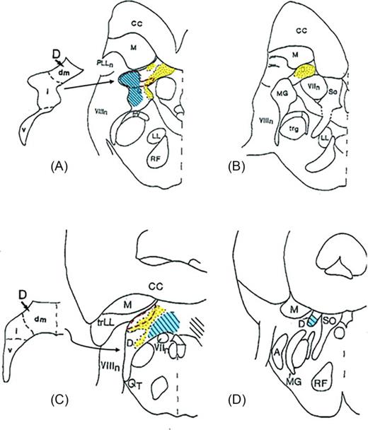 (Color online) Line drawings of hemisections through two levels of the descending nucleus in (A) and (B) the bowfin, and (C) and (D) the gizzard shad. Otolith endorgan inputs to the most dorsal neurons in descending nucleus, here labeled dm, differ. Saccular terminals occupy the stippled area (yellow online), utricular terminals occupy the area with diagonal lines (blue online), and lagenar terminals occupy the area enclosed by the dashed line (red online). In goldfish, as in other species, the saccular nerve supplies the most medial neurons, whereas in the gizzard shad, the utricular nerve projects to these neurons. Adapted from McCormick (1999). “Anatomy of the central auditory pathways of fish and amphibians,” in Comparative Hearing: Fish and Amphibians by R. R. Fay, and A. N. Popper (Springer, New York), pp. 155–217, edited with permission of Springer Nature. Abbreviations: A, anterior octaval nucleus; CC; cerebellar crest; D, descending octaval nucleus; dm, dorsal-most zone of the descending nucleus; I, intermediate zone of the descending nucleus; v, ventral zone of the descending nucleus; LL, lateral lemniscus; M, nucleus medialis; MG; magnocellular octaval nucleus; PLLn, posterior lateral line nerve; R, reticular formation; SO, secondary octaval population; T, nucleus tangentialis; trg, secondary gustatory tract; trLL, ascending and descending tracts of the lateral line nerves; trV, descending trigeminal tract; VIIn, sensory root of the facial nerve; VIIIn, eighth nerve.