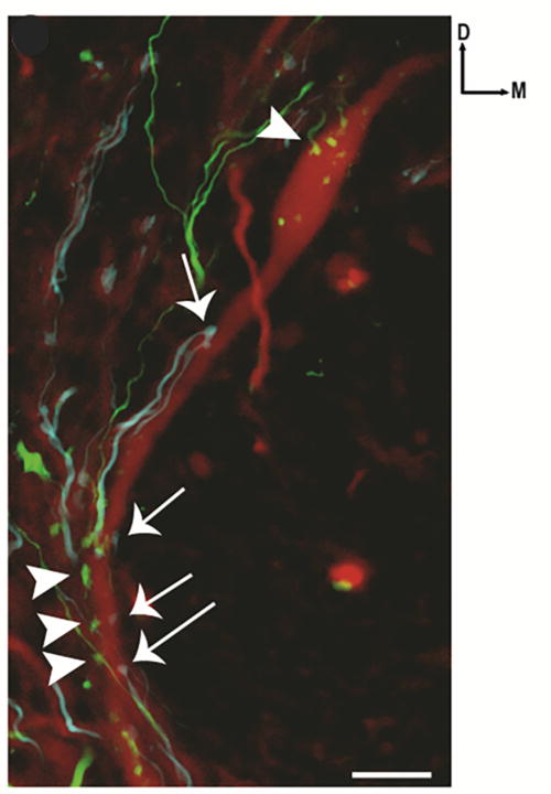 (Color online) A neuron in one of the lateral dDO populations (Ld-rf) fluorescently stained red (online). The upper arrowhead indicates saccular input (green online) on the soma, and the three lower arrowheads show saccular input (green online) on the ventral dendrite. The four arrows point to utricular inputs (blue online) on the ventral dendrite. Bar scale = 10 μm. Adapted from McCormick and Wallace (2012). “Otolith end organ projections to auditory neurons in the descending octaval nucleus of the goldfish, Carassius auratus: a confocal analysis,” Brain Behav. Evol. 80, 41–63, with permission of Karger Publishers; Copyright 2012 Karger Publishers, Basel, Switzerland.