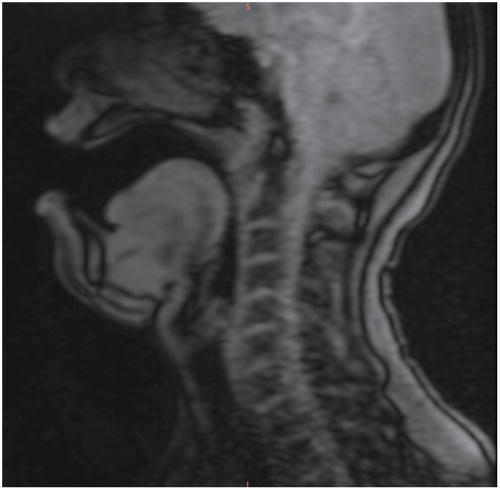 (Color online) One frame of the MRI data for building the planned phonetic target model showing the midsagittal view of the vocal tract.
