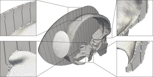 (Color online) The fully unstructured hexahedral mesh used for demonstrating the coupled viscoacoustic-viscoelastic wave equation on a domain with considerable geometric complexity. The bowl-type transducer, which is placed at the posterior of the cranium, is also shown to illustrate the phyllotaxis pattern used for distributing the point sources evenly over the transducer's surface. Portions of the mesh have been removed to reveal the internal structure of the hexahedral mesh. The highlighted locations demonstrate particularly complex regions of the mesh, which are still resolved using the meshing scheme discussed in Sec. III A.