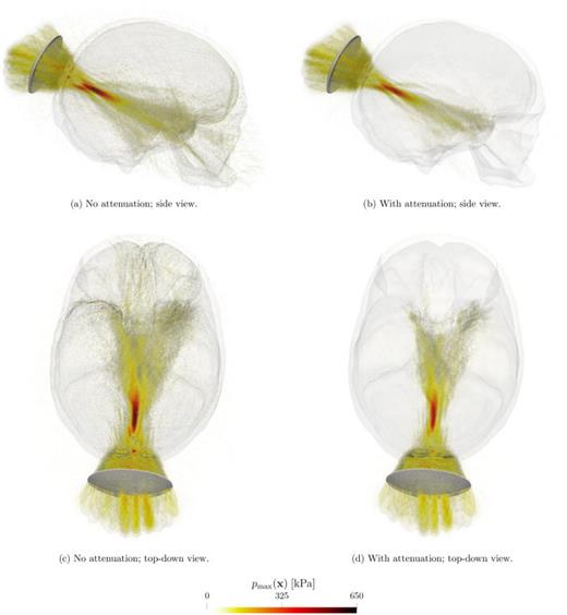 (Color online) Maximum pressure distributions in the MIDA phantom. The maximum pressure between the non-attenuative and attenuative cases changes from approximately 640.5 kPa to 516.5 kPa, respectively. This difference of approximately 20% illustrates the importance of modeling the effects of attenuation to ensure that the pressures in the interior brain tissue are not overestimated.