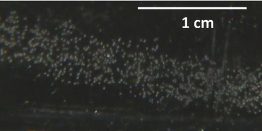 FIG. 1. Bubbles form along the laser beam line in response to a single laser pulse. The supersaturation was c/csat = 2.50. The laser produced 280 mJ/pulse at a wavelength of 532 nm, far above the threshold for laser-induced bubble nucleation.