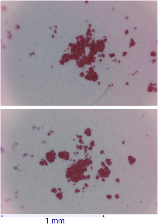 Magnified views of two contact regions from Fig. 35. The linear size of the (macroasperity) contact regions is 2r0 ∼ 0.2–0.4 mm.