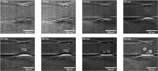 FIG. 6. Image sequence of laser-spot welding with 515 nm with focal position 1 mm offset in the z-axis.
