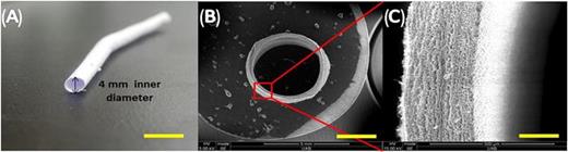 Fig. 2. (Color online) Photograph of flexible small-caliber tubular graft. (a) SEM image of the cross section of the tube (b) and enlarged wall (c) showing porous and fibrous morphology and the wall thickness. It is approximately 300–400 μm in thickness. Scale bar in (a) is 10 mm. Scale bar in (b) is 2.5 mm. Scale bar in (c) is 300 μm.