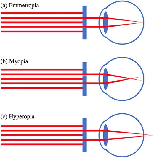 Measurement of the peripheral aberrations of human eyes: A ...