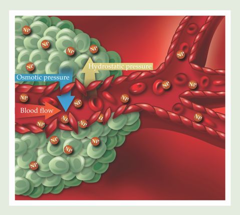 . Figure 1. The blood vessels in solid tumors have irregular linings, with gaps much bigger than the ones in healthy blood vessels. Nanoparticles (NP) less than 300 nm in diameter can pass through those gaps and accumulate in the tumors through a purely physical phenomenon called the enhanced permeability and retention effect. (Cartoon not drawn to scale.)
