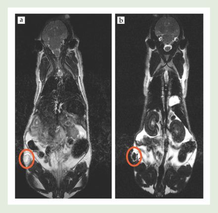 . Figure 3. Iron oxide nanoparticles were injected into a mouse implanted with a colon cancer tumor (circled in orange). (a) Before injection, the tumor appeared bright in a magnetic resonance image. (b) Twenty-four hours after injection, accumulation of nanoparticles caused the tumor to appear dark. In fact, the contrast in the tumor was still increasing after 24 hours. (Courtesy of Marcelino Bernardo and Lilia Ileva.)