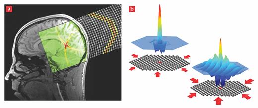 Figure 5. Tunable precompression.(a) An acoustic lens can be made from a granular crystal such as the two- dimensional array of spheres illustrated here. In this fanciful depiction, an incident acoustic signal generates traveling waves that, provided the crystal is properly clamped, experience phase delays and constructively interfere to focus the signal into a highly localized pulse known as a sound bullet. The focused pulse is superimposed on a brain MRI scan to suggest possible medical applications. (b) In a hexagonal crystal array containing a single, small-mass defect (red), one can tune the particles’ oscillations near the defect from localized to delocalized by varying the extent of precompression (red arrows) at the crystal boundaries.17 (Panel a courtesy of Alessandro Spadoni and Mike Tysazka; panel b adapted from ref. 17.)