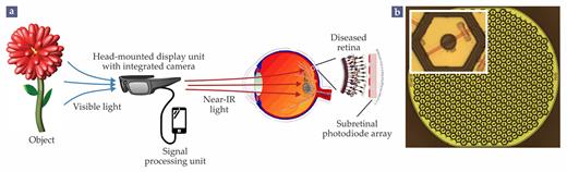Figure 5. A PRIMA prosthesis. (a) In the photovoltaic (PV) PRIMA system, a visual scene is captured with a head-mounted camera, processed with a mobile computer, and relayed to a patient’s eye in intense bursts of near-IR light. The images are projected via the natural optics of the eye onto a subretinal PV array that takes the place of the photoreceptor layer in the retina. (Adapted from G. A. Goetz, D. V. Palanker, Rep. Prog. Phys. 79, 096701, 2016.) (b) A single 1 mm module of the PV array consisting of about 250 pixels, 55 µm across, arranged in a hexagonal pattern. The inset shows a close-up of a single pixel, composed of two photodiodes and two electrodes. Larger or mulitple modules can be placed to cover a larger visual field.