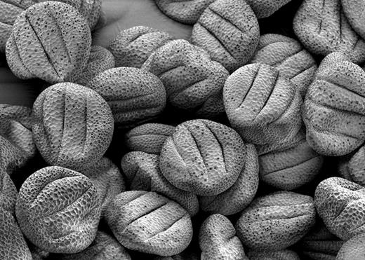 . Brownian motion, or the random motion of particles suspended in a liquid or gas, was first observed in 1827 by botanist Robert Brown, who saw minuscule particles moving within pollen grains such as those pictured here. 