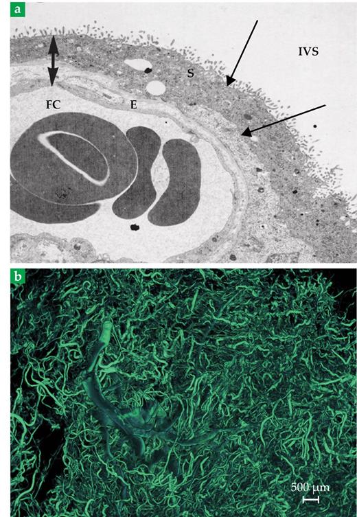 The complexities of the human placenta | Physics Today | AIP Publishing