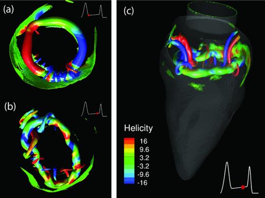 Vortex formation and instability in the left ventricle | Physics of ...